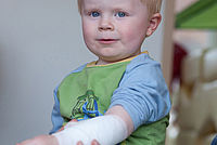 Auf dem Bild ist ein Nahaufnahme eines etwa vierjährigen Kindes zu sehen. Das Kind zeigt seinen verbundenen Arm, den es in die Kamera hält.